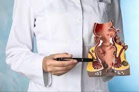 Venous/Hemorrhoidal